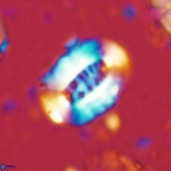 Ellipsolithus lajollaensis VR 02820