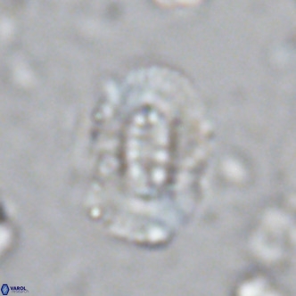 Ellipsolithus lajollaensis VR 02822