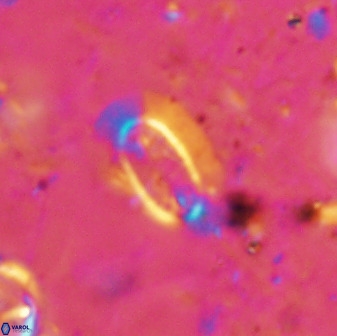 Ellipsolithus pumex 50435