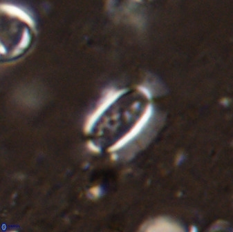 Ellipsolithus pumex 50436