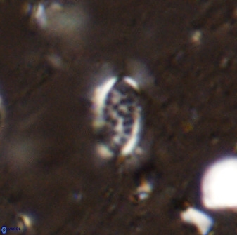 Ellipsolithus pumex 50432