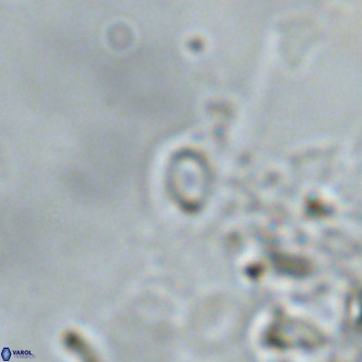 Emiliania huxleyi VR 02191