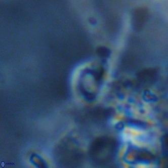 Emiliania huxleyi VR 02192