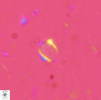Enaplakalithus perspicuum 2297