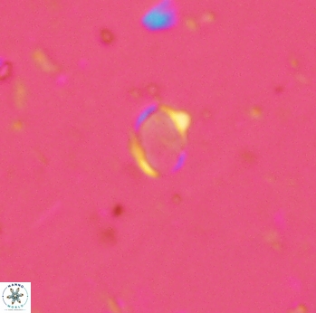 Enaplakalithus perspicuum 2298