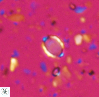 Enaplakalithus perspicuum 6906