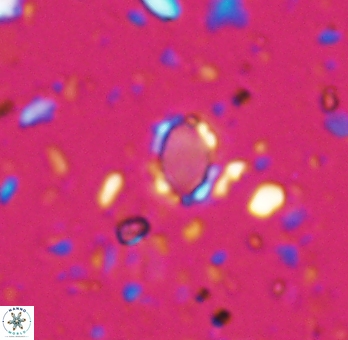 Enaplakalithus perspicuum 6907