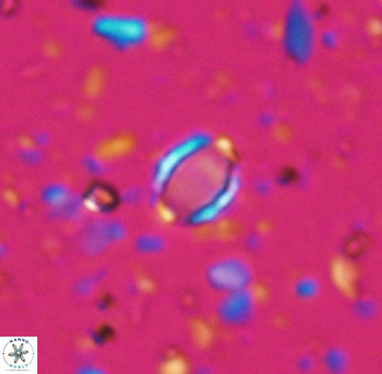 Enaplakalithus perspicuum 6910