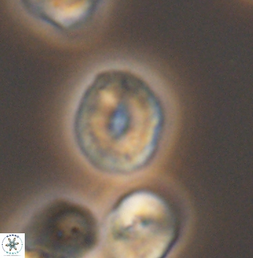 Esgia ellipticus 11379