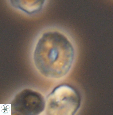 Esgia ellipticus 11380
