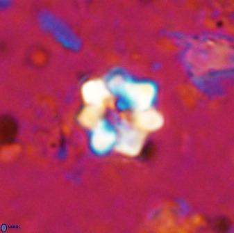Eprolithus moratus 35808