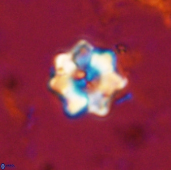 Eprolithus moratus 36103