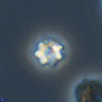 Eprolithus moratus 40251