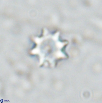 Eprolithus octopetalus 35359