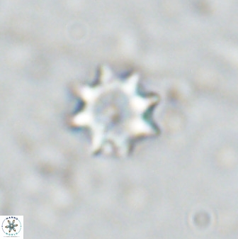 Eprolithus octopetalus 35359