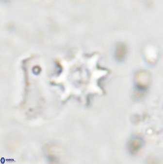 Eprolithus octopetalus 36936