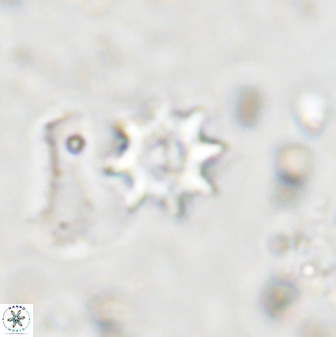 Eprolithus octopetalus 36936