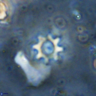 Eprolithus octopetalus 36938