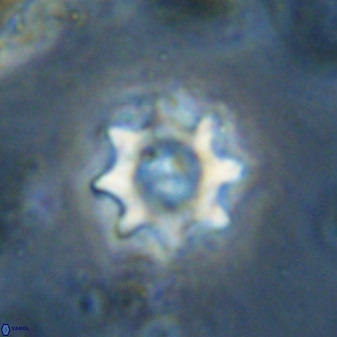 Eprolithus octopetalus 37789
