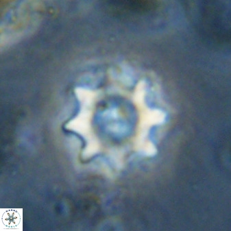 Eprolithus octopetalus 37789