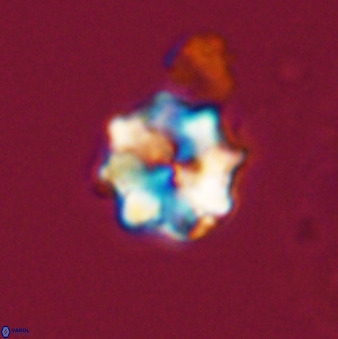 Eprolithus octuplus 41662