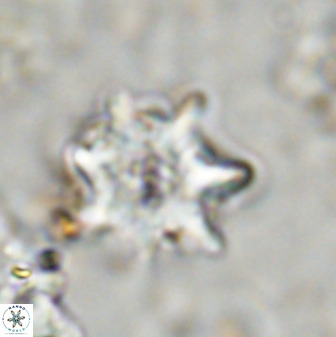 Eprolithus eptapetalus 36374
