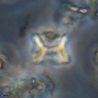 Eprolithus eptapetalus 40668