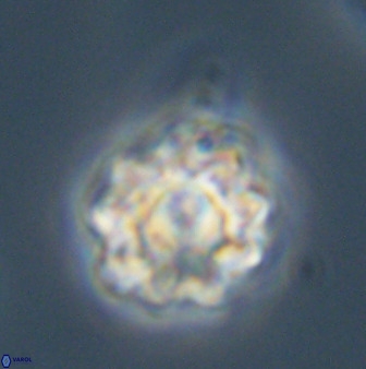 Eprolithus floralis 39887