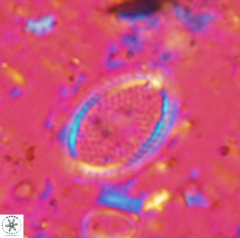 Ethmorhabdus gallicus 33174