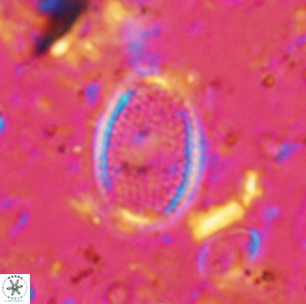 Ethmorhabdus gallicus 33175