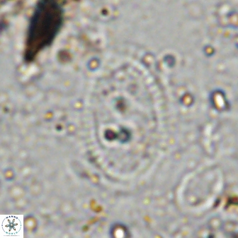 Ethmorhabdus gallicus 33179