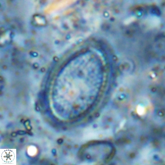 Ethmorhabdus gallicus 33180