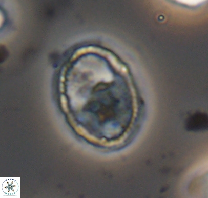 Ethmorhabdus hauterivianus 10760