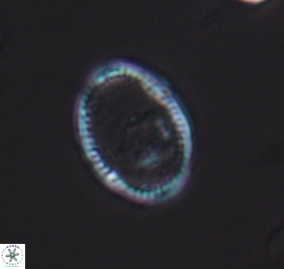 Ethmorhabdus hauterivianus 10762