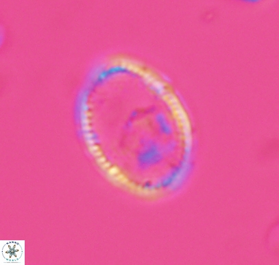 Ethmorhabdus hauterivianus 10763