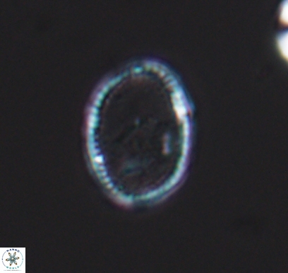 Ethmorhabdus hauterivianus 10764