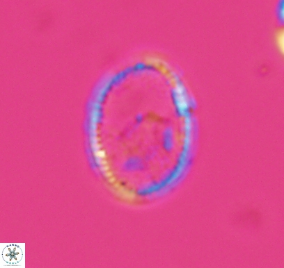 Ethmorhabdus hauterivianus 10765