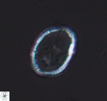 Ethmorhabdus hauterivianus 10766