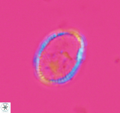 Ethmorhabdus hauterivianus 10767