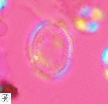 Ethmorhabdus hauterivianus 2961
