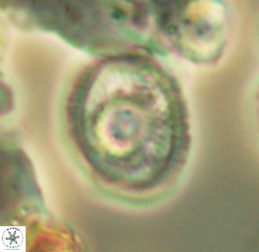 Ethmorhabdus hauterivianus 2962