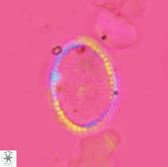 Ethmorhabdus hauterivianus 3596