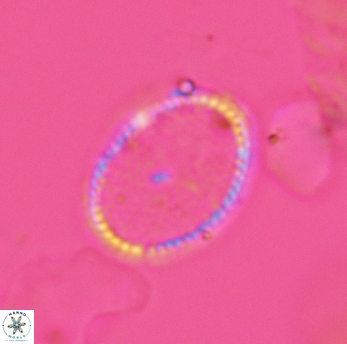 Ethmorhabdus hauterivianus 3598