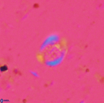 Falklandicus praereticulatus 38376