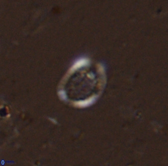 Falklandicus praereticulatus 38377