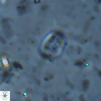 Falklandicus praereticulatus 38370
