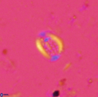 Falklandicus praereticulatus 38373