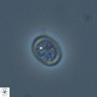 Falklandolithus praereticulatus 40688