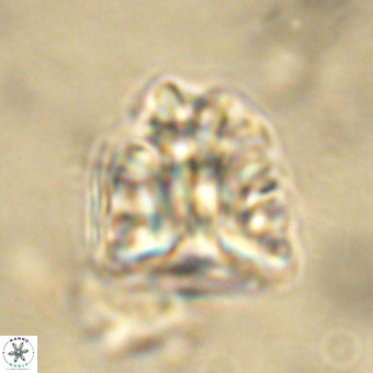 Fasciculithus bobbii VR 00040