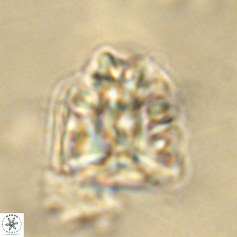 Fasciculithus bobbii VR 00041